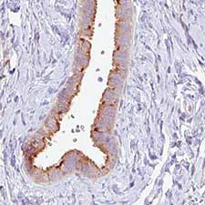 Immunohistochemistry (Formalin/PFA-fixed paraffin-embedded sections) - Anti-PCM1 antibody [CL0206] (AB154142)