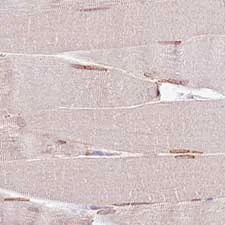 Immunohistochemistry (Formalin/PFA-fixed paraffin-embedded sections) - Anti-PCM1 antibody [CL0206] (AB154142)