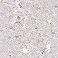 Immunohistochemistry (Formalin/PFA-fixed paraffin-embedded sections) - Anti-PCM1 antibody [CL0206] (AB154142)