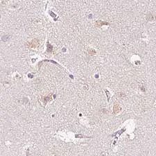 Immunohistochemistry (Formalin/PFA-fixed paraffin-embedded sections) - Anti-PCM1 antibody [CL0206] (AB154142)