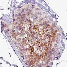 Immunohistochemistry (Formalin/PFA-fixed paraffin-embedded sections) - Anti-PCM1 antibody [CL0206] (AB154142)