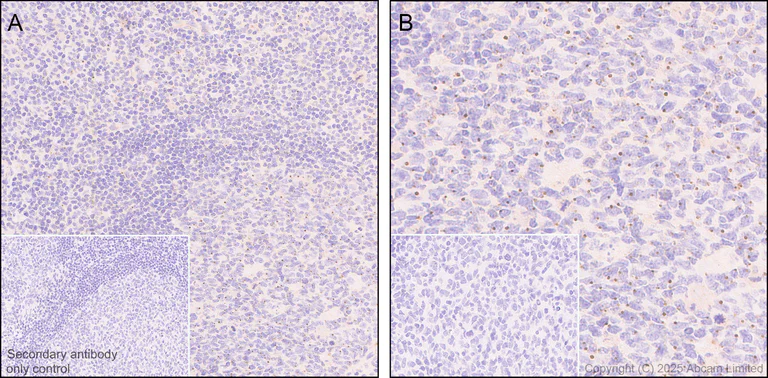 Immunohistochemistry (Formalin/PFA-fixed paraffin-embedded sections) - Anti-PCM1 antibody [EPR30467-546] (AB324615)