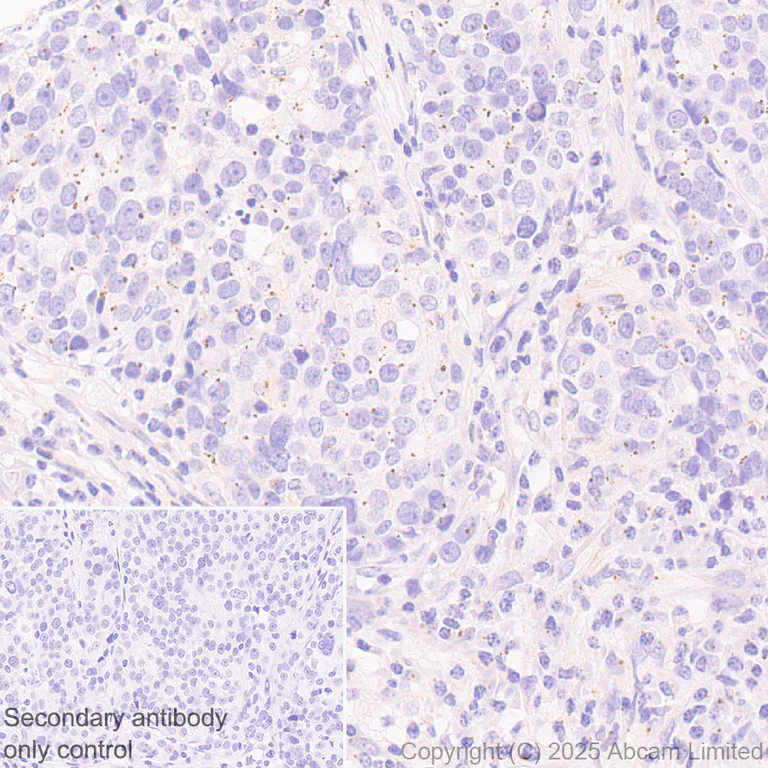 Immunohistochemistry (Formalin/PFA-fixed paraffin-embedded sections) - Anti-PCM1 antibody [EPR30467-546] (AB324615)