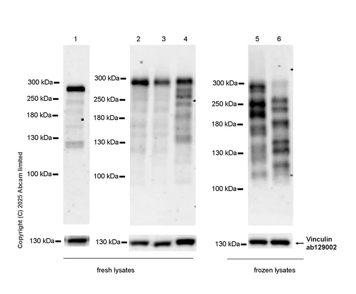 Western blot - Anti-PCM1 antibody [EPR30467-546] (AB324615)