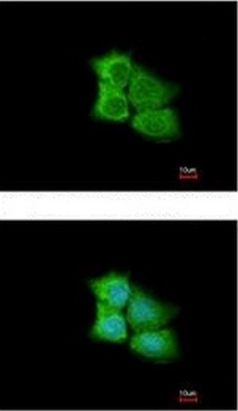Immunocytochemistry/ Immunofluorescence - Anti-PCMT1 antibody (AB192790)