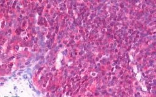 Immunohistochemistry (Formalin/PFA-fixed paraffin-embedded sections) - Anti-PCMT1 antibody (AB192790)