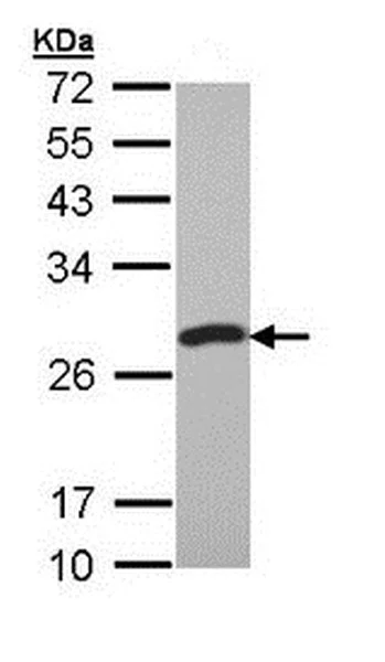 Western blot - Anti-PCMT1 antibody (AB192790)