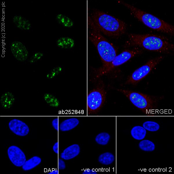 Immunocytochemistry/ Immunofluorescence - Anti-PCNA antibody [16D10] (AB252848), expandable thumbnail