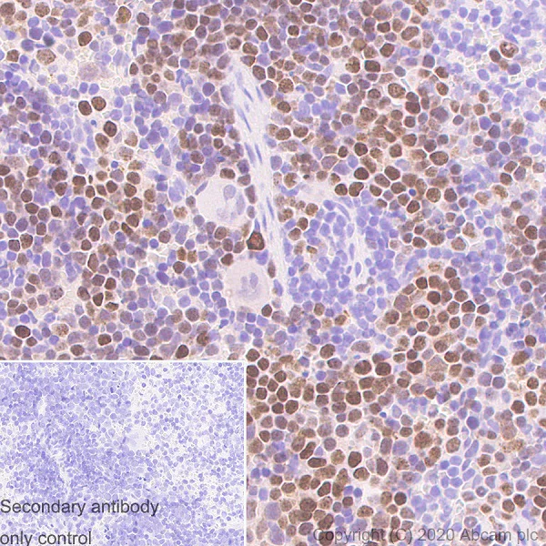 Immunohistochemistry (Formalin/PFA-fixed paraffin-embedded sections) - Anti-PCNA antibody [24/PCNA] - BSA and Azide free (AB280093)