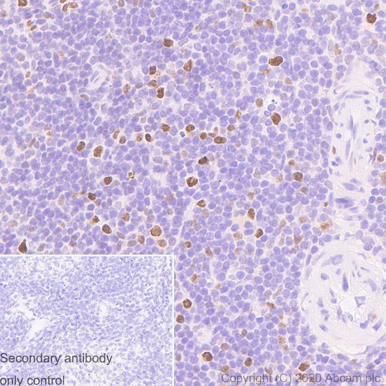 Immunohistochemistry (Formalin/PFA-fixed paraffin-embedded sections) - Anti-PCNA antibody [24/PCNA] - BSA and Azide free (AB280093)