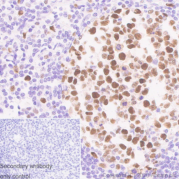 Immunohistochemistry (Formalin/PFA-fixed paraffin-embedded sections) - Anti-PCNA antibody [24/PCNA] - BSA and Azide free (AB280093)