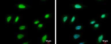 Immunocytochemistry/ Immunofluorescence - Anti-PCNA antibody (AB152112)