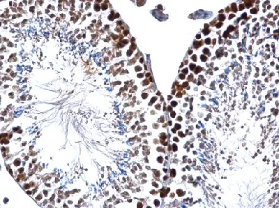 Immunohistochemistry (Formalin/PFA-fixed paraffin-embedded sections) - Anti-PCNA antibody (AB152112)