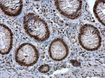 Immunohistochemistry (Formalin/PFA-fixed paraffin-embedded sections) - Anti-PCNA antibody (AB152112)