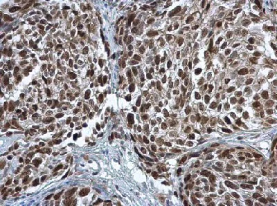 Immunohistochemistry (Formalin/PFA-fixed paraffin-embedded sections) - Anti-PCNA antibody (AB152112)
