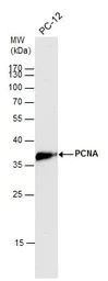 Western blot - Anti-PCNA antibody (AB152112)