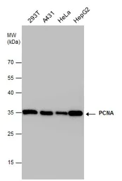 Western blot - Anti-PCNA antibody (AB152112)