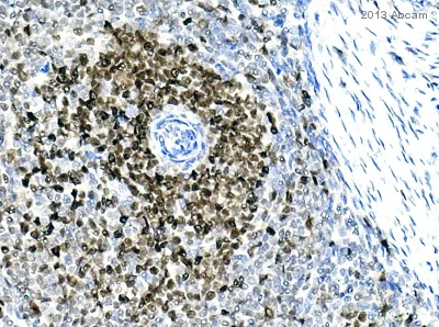 Immunohistochemistry (Formalin/PFA-fixed paraffin-embedded sections) - Anti-PCNA antibody (AB18197)
