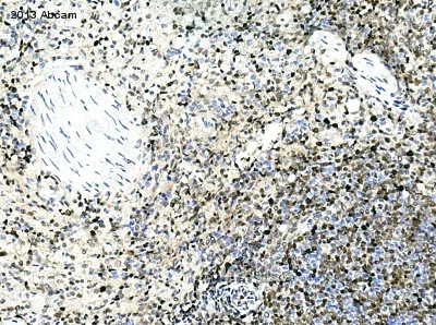 Immunohistochemistry (Formalin/PFA-fixed paraffin-embedded sections) - Anti-PCNA antibody (AB18197)