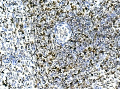 Immunohistochemistry (Formalin/PFA-fixed paraffin-embedded sections) - Anti-PCNA antibody (AB18197)