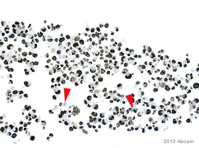 Immunohistochemistry (Formalin/PFA-fixed paraffin-embedded sections) - Anti-PCNA antibody (AB18197)