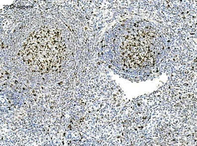 Immunohistochemistry (Formalin/PFA-fixed paraffin-embedded sections) - Anti-PCNA antibody (AB18197)