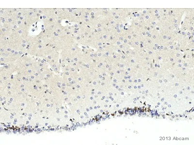 Immunohistochemistry (Formalin/PFA-fixed paraffin-embedded sections) - Anti-PCNA antibody (AB18197)