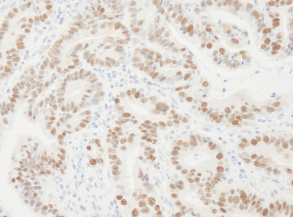 Immunohistochemistry (Formalin/PFA-fixed paraffin-embedded sections) - Anti-PCNA antibody (AB19166), expandable thumbnail
