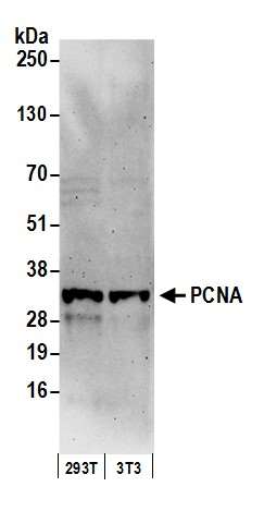 Western blot - Anti-PCNA antibody (AB19166), expandable thumbnail