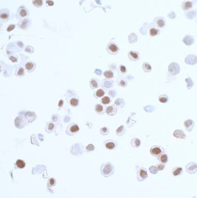 Immunocytochemistry - Anti-PCNA antibody [BLR075G] (AB265609), expandable thumbnail