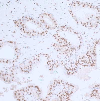 Immunohistochemistry (Formalin/PFA-fixed paraffin-embedded sections) - Anti-PCNA antibody [BLR075G] (AB265609), expandable thumbnail