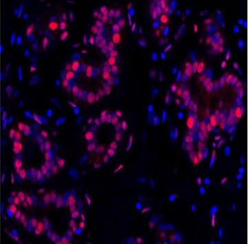 Immunohistochemistry (Formalin/PFA-fixed paraffin-embedded sections) - Anti-PCNA antibody [BLR075G] (AB265609), expandable thumbnail