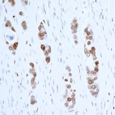 Immunohistochemistry (Formalin/PFA-fixed paraffin-embedded sections) - Anti-PCNA antibody [BLR075G] (AB265609), expandable thumbnail