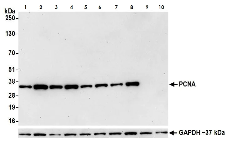 Western blot - Anti-PCNA antibody [BLR075G] (AB265609)
