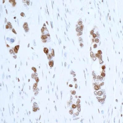 Immunohistochemistry (Formalin/PFA-fixed paraffin-embedded sections) - Anti-PCNA antibody [BLR075G] - BSA free (AB272076)