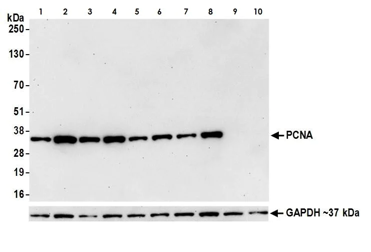Western blot - Anti-PCNA antibody [BLR075G] - BSA free (AB272076)