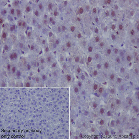 Immunohistochemistry (Formalin/PFA-fixed paraffin-embedded sections) - Anti-PCNA antibody [EPR3821] (AB92552)