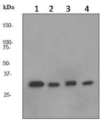 Western blot - Anti-PCNA antibody [EPR3821] (AB92552)