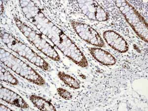 Immunohistochemistry (Formalin/PFA-fixed paraffin-embedded sections) - Anti-PCNA antibody [EPR3821] - BSA and Azide free (AB218310)