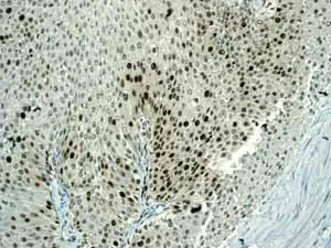 Immunohistochemistry (Formalin/PFA-fixed paraffin-embedded sections) - Anti-PCNA antibody [EPR3821] - BSA and Azide free (AB218310)