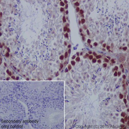 Immunohistochemistry (Formalin/PFA-fixed paraffin-embedded sections) - Anti-PCNA antibody [EPR3821] - BSA and Azide free (AB218310)