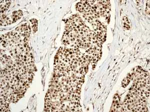Immunohistochemistry (Formalin/PFA-fixed paraffin-embedded sections) - Anti-PCNA antibody [EPR3821] - BSA and Azide free (AB218310)