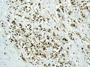 Immunohistochemistry (Formalin/PFA-fixed paraffin-embedded sections) - Anti-PCNA antibody [EPR3821] - BSA and Azide free (AB218310)