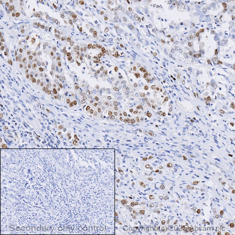 Immunohistochemistry (Formalin/PFA-fixed paraffin-embedded sections) - Anti-PCNA antibody [EPR3821] - BSA and Azide free (AB218310)