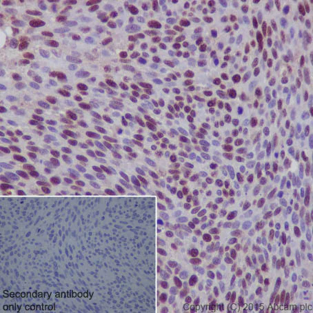 Immunohistochemistry (Formalin/PFA-fixed paraffin-embedded sections) - Anti-PCNA antibody [EPR3821] - BSA and Azide free (AB218310)
