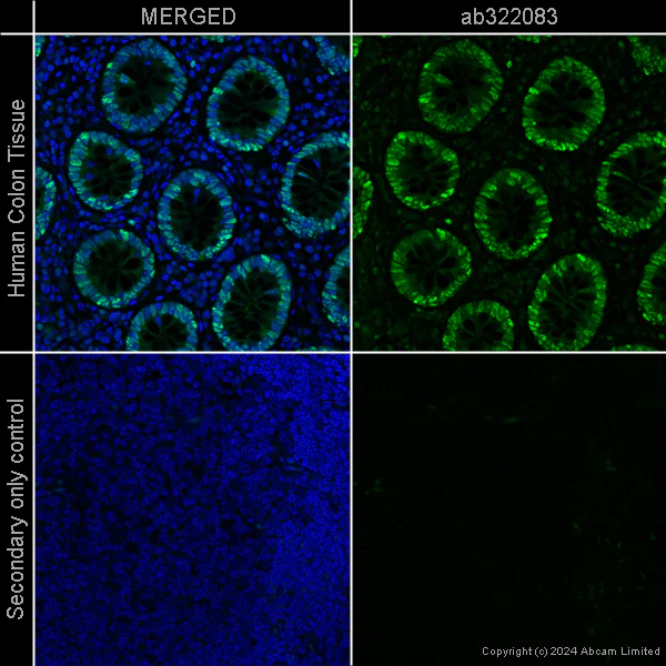 Immunohistochemistry (Formalin/PFA-fixed paraffin-embedded sections) - Anti-PCNA antibody [EPR3821] – Chicken IgY (Chimeric) – BSA and Azide Free (AB322919)