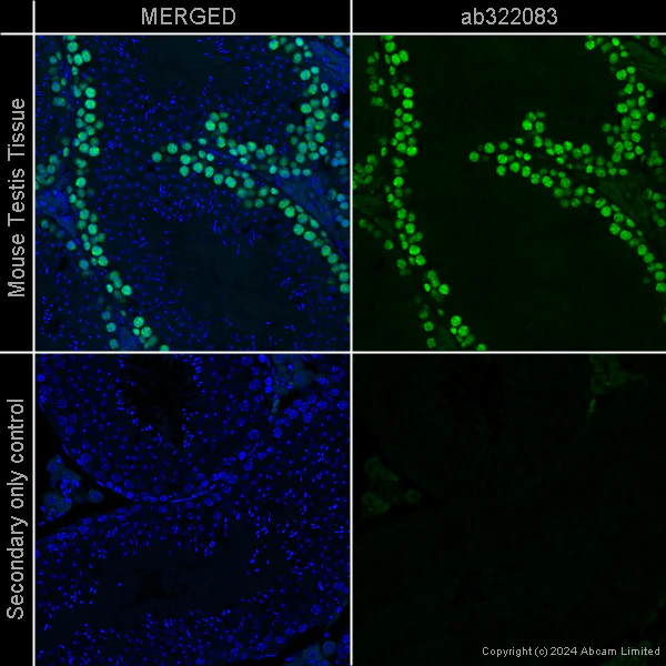 Immunohistochemistry (Formalin/PFA-fixed paraffin-embedded sections) - Anti-PCNA antibody [EPR3821] – Chicken IgY (Chimeric) – BSA and Azide Free (AB322919)