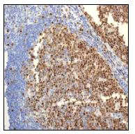 Immunohistochemistry (Formalin/PFA-fixed paraffin-embedded sections) - Anti-PCNA antibody [EPR3822] - BSA and Azide free (AB247595)