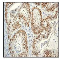 Immunohistochemistry (Formalin/PFA-fixed paraffin-embedded sections) - Anti-PCNA antibody [EPR3822] - BSA and Azide free (AB247595)