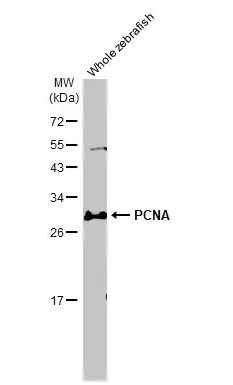Western blot - Anti-PCNA antibody [HL1965] (AB308212)
